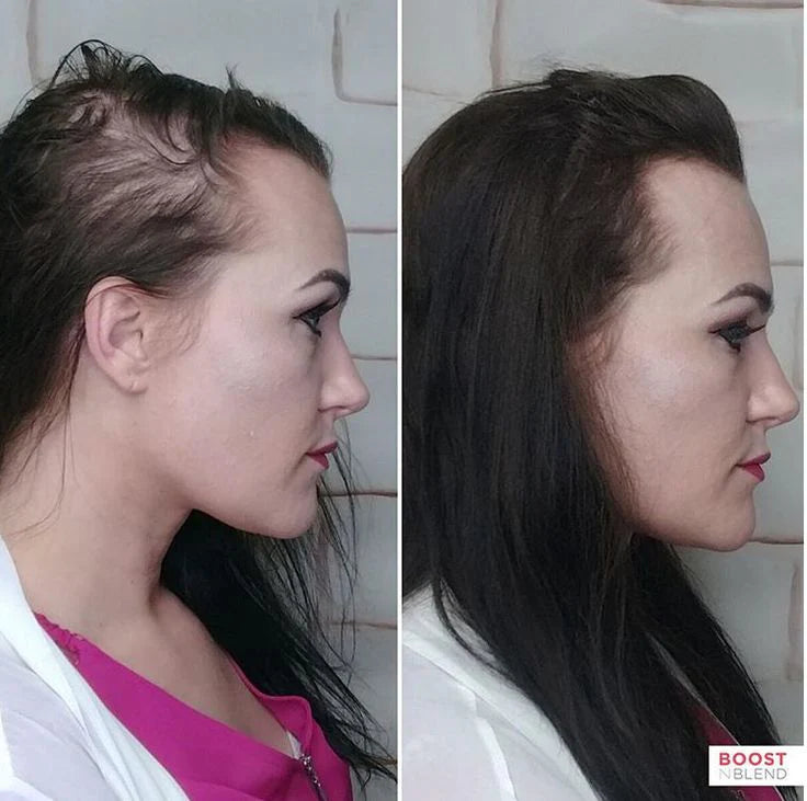 Hair Grower: Electric Scalp Massager